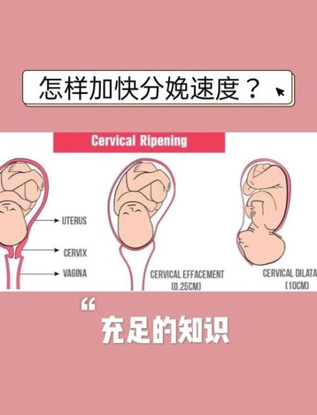 世界上最小的孕妇_她如何顺利分娩-第1张图片-星辰妙记