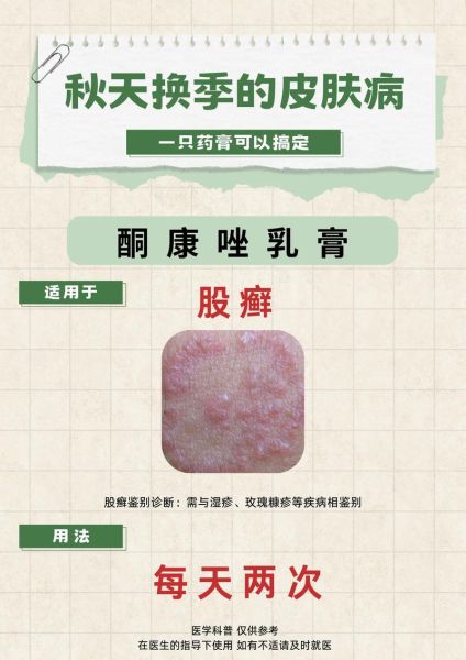 孕妇能用什么药膏_孕妇湿疹用什么药膏安全-第3张图片-星辰妙记