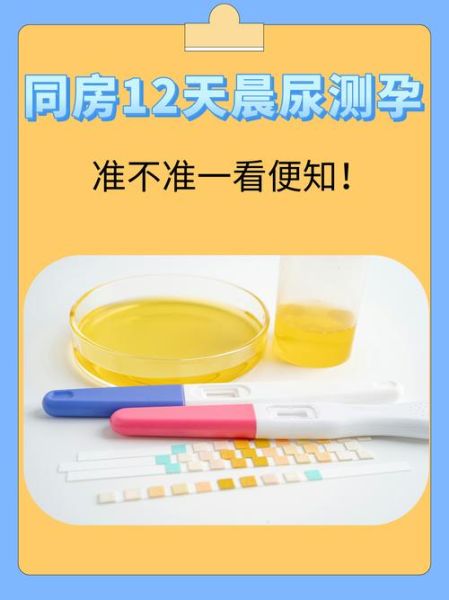 孕妇尿液有什么用_孕妇尿液检测能查什么-第1张图片-星辰妙记 孕妇尿液有什么用_孕妇尿液检测能查什么-第1张图片-星辰妙记