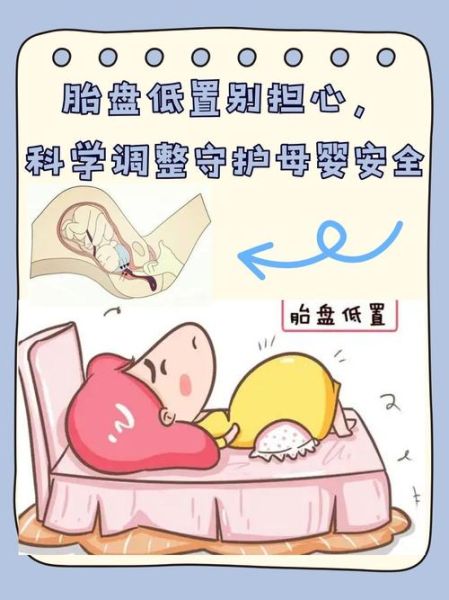 孕妇胎盘低置怎么办_胎盘低置能顺产吗-第1张图片-星辰妙记 孕妇胎盘低置怎么办_胎盘低置能顺产吗-第1张图片-星辰妙记