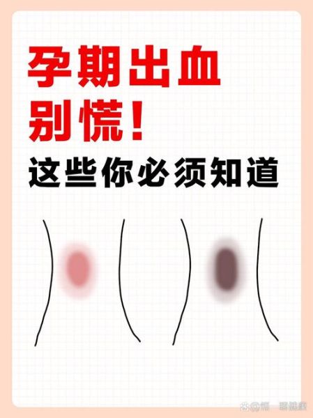 孕妇见红怎么办_见红后多久会生-第2张图片-星辰妙记 孕妇见红怎么办_见红后多久会生-第2张图片-星辰妙记