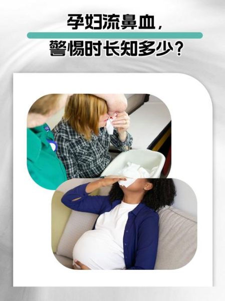 孕妇流鼻血对胎儿有影响吗_孕妇经常流鼻血怎么办-第1张图片-星辰妙记