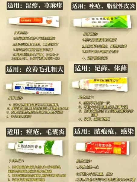 孕妇能用的皮肤软膏有哪些_孕妇湿疹用什么药膏安全-第1张图片-星辰妙记