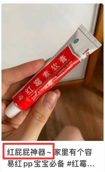 孕妇可以涂红霉素软膏吗_红霉素软膏对胎儿有影响吗-第3张图片-星辰妙记