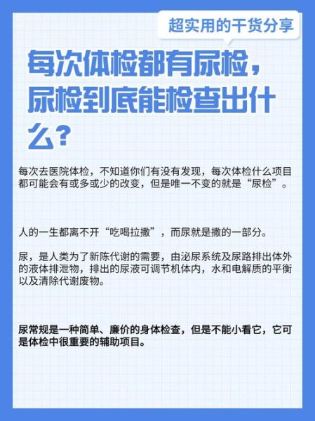 孕妇尿检什么时候做_孕妇尿检能查出什么-第1张图片-星辰妙记