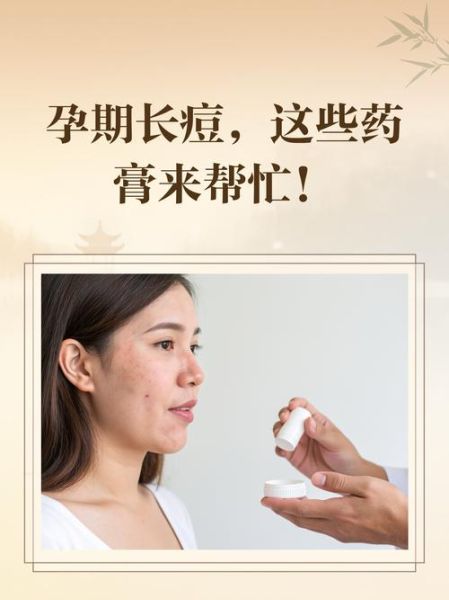 孕妇可以闻膏药吗_孕妇闻膏药对胎儿有影响吗-第3张图片-星辰妙记