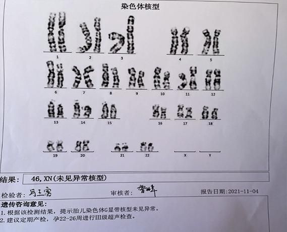 羊水穿刺能检查什么_羊水穿刺检查哪些染色体异常-第2张图片-星辰妙记