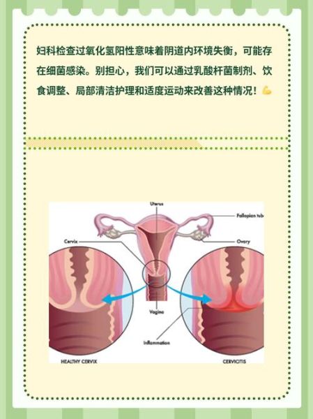 孕妇过氧化氢阳性什么意思_对胎儿有影响吗-第1张图片-星辰妙记