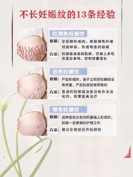 孕妇纹怎么消除_孕妇纹什么时候开始出现-第1张图片-星辰妙记