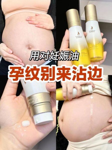 孕妇纹怎么消除_孕妇纹什么时候开始出现-第2张图片-星辰妙记