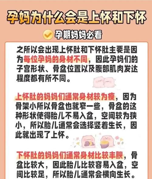 孕妇下怀好还是上怀好_区别与注意事项-第1张图片-星辰妙记