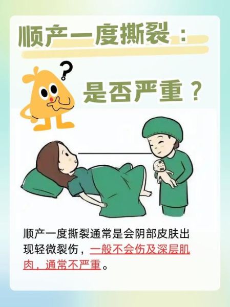 孕妇真菌感染能顺产吗_对胎儿有影响吗-第1张图片-星辰妙记