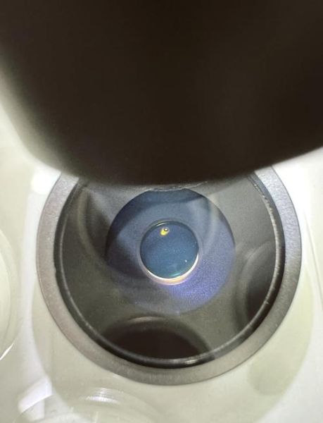 镜头灰是什么_如何清理镜头灰-第1张图片-星辰妙记