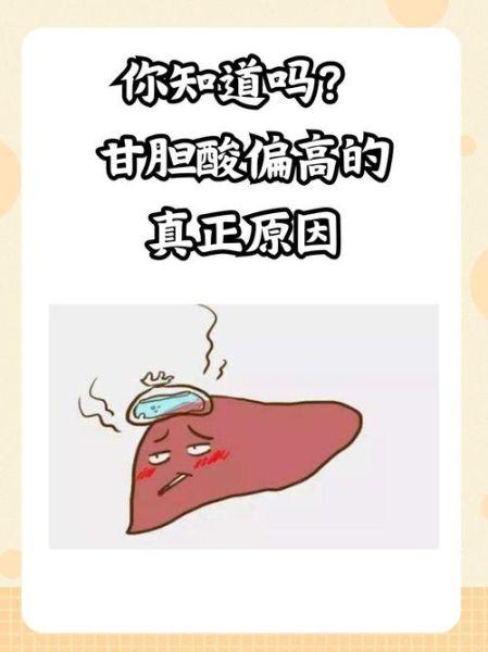 孕妇甘胆酸偏高怎么办_对胎儿有什么影响-第2张图片-星辰妙记