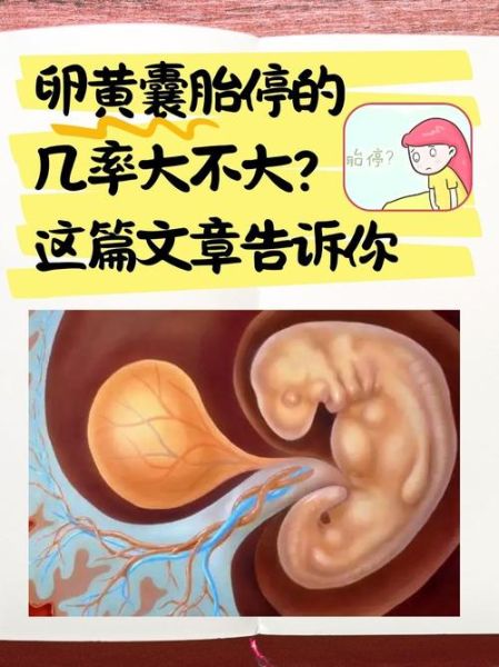 孕妇看黄谍胎儿有记忆吗_会影响宝宝大脑发育吗-第1张图片-星辰妙记 孕妇看黄谍胎儿有记忆吗_会影响宝宝大脑发育吗-第1张图片-星辰妙记