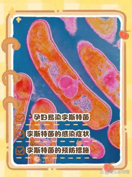 孕妇感染李斯特菌的症状_如何避免李斯特菌感染-第1张图片-星辰妙记 孕妇感染李斯特菌的症状_如何避免李斯特菌感染-第1张图片-星辰妙记