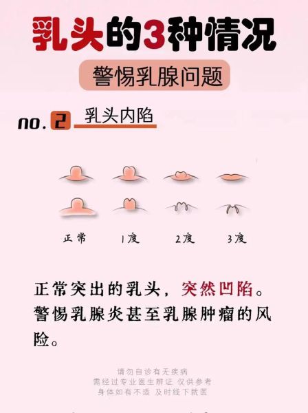孕妇乳头痒怎么办_孕妇乳头痒是什么原因-第2张图片-星辰妙记