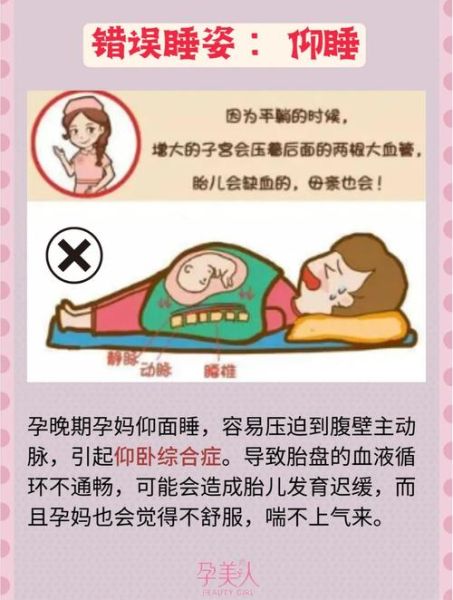 孕妇睡姿左侧还是右侧_孕妇睡姿会影响胎儿吗-第2张图片-星辰妙记