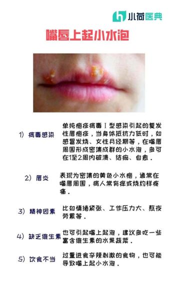 孕妇嘴角长疱疹怎么办_会影响胎儿吗-第1张图片-星辰妙记 孕妇嘴角长疱疹怎么办_会影响胎儿吗-第1张图片-星辰妙记