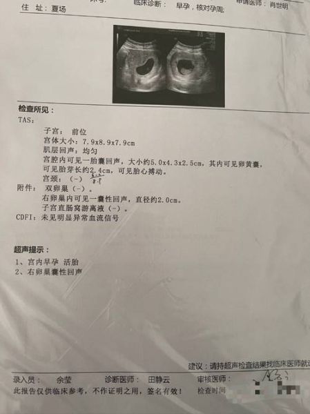 孕妇b超需要空腹吗_孕早期b超注意事项-第2张图片-星辰妙记 孕妇b超需要空腹吗_孕早期b超注意事项-第2张图片-星辰妙记