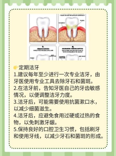 孕妇牙龈发炎肿痛怎么办_孕妇牙龈肿痛快速止痛方法-第3张图片-星辰妙记