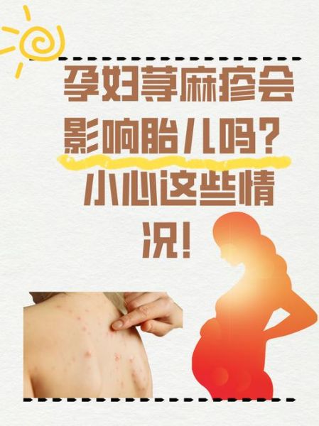 孕妇看望病人对谁不好_会影响胎儿吗-第3张图片-星辰妙记