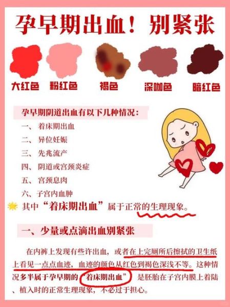 孕妇梦见见红是什么意思_孕妇梦见见红是胎梦吗-第3张图片-星辰妙记