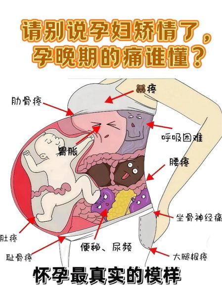 孕妇肚皮撑的疼怎么办_孕晚期肚皮紧绷怎么缓解-第1张图片-星辰妙记