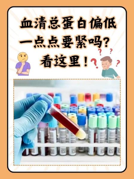 孕妇总蛋白偏低是什么原因_怎么办-第1张图片-星辰妙记