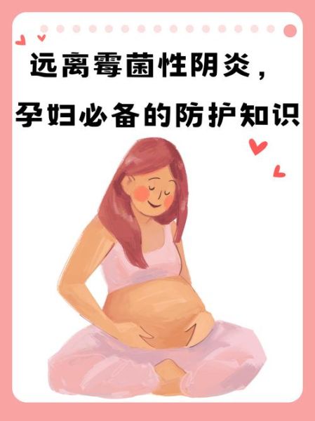 孕妇霉菌感染能自愈吗_孕期霉菌反复发作怎么办-第1张图片-星辰妙记