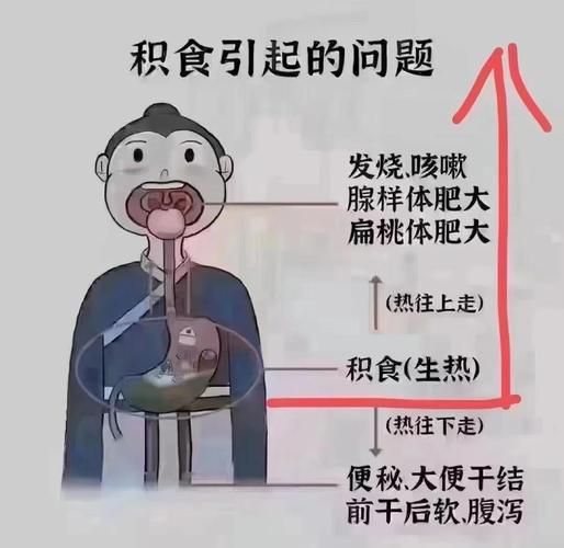 孕妇胃积食难受怎么办_缓解方法有哪些-第1张图片-星辰妙记
