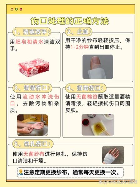 孕妇能用酒精消毒吗_孕期酒精消毒安全指南-第1张图片-星辰妙记