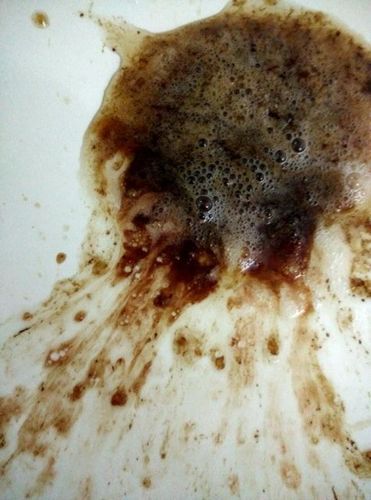 孕妇呕吐出血有危险吗_孕吐带血怎么办-第2张图片-星辰妙记