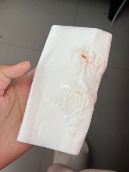 孕妇呕吐出血有危险吗_孕吐带血怎么办-第3张图片-星辰妙记