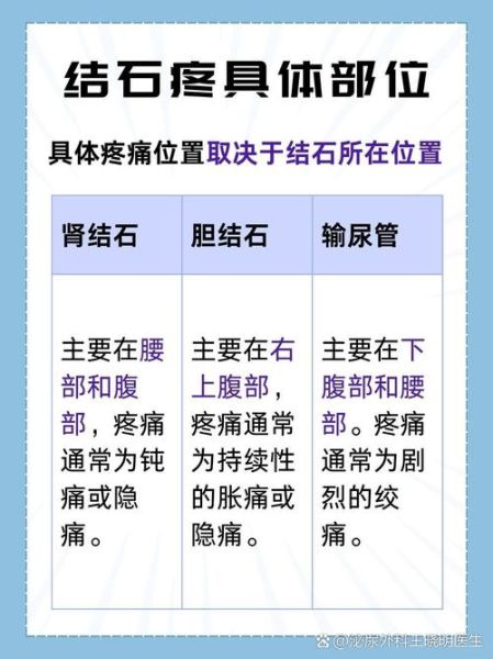 孕妇尿路结石怎么办_孕妇肾结石疼痛缓解方法-第3张图片-星辰妙记