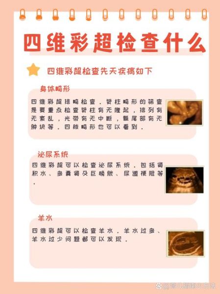 孕妇四维彩超什么时候做_四维彩超检查什么-第2张图片-星辰妙记