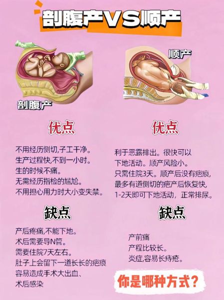 顺产好还是剖腹产好_孕妇怎么选-第1张图片-星辰妙记