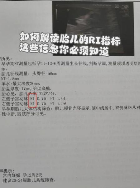 孕妇RI正常值是多少_孕妇RI偏高怎么办-第1张图片-星辰妙记