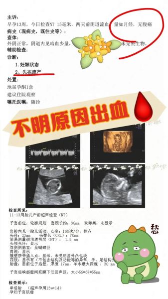 孕妇七个月出血是怎么回事_七个月出血怎么办-第3张图片-星辰妙记