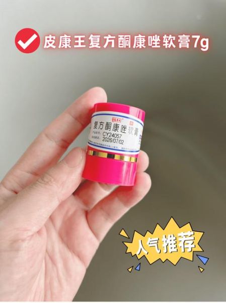 孕妇长癣可以用什么药膏_对胎儿有影响吗-第1张图片-星辰妙记