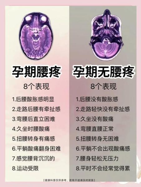 孕妇腰疼怎么办_孕妇腰疼怎么缓解-第1张图片-星辰妙记