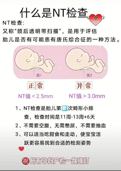 孕妇nt检查是什么_孕妇nt检查最佳时间-第3张图片-星辰妙记