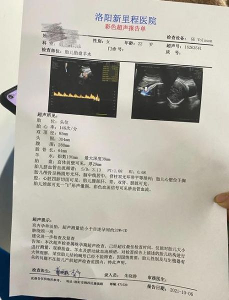 孕妇sd值是什么意思_孕妇sd值偏高怎么办-第1张图片-星辰妙记 孕妇sd值是什么意思_孕妇sd值偏高怎么办-第1张图片-星辰妙记