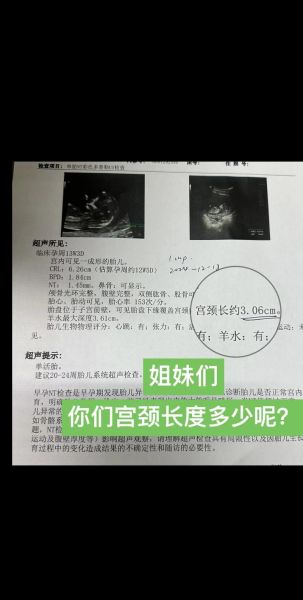 孕妇子宫颈长度正常范围_宫颈短怎么办-第3张图片-星辰妙记