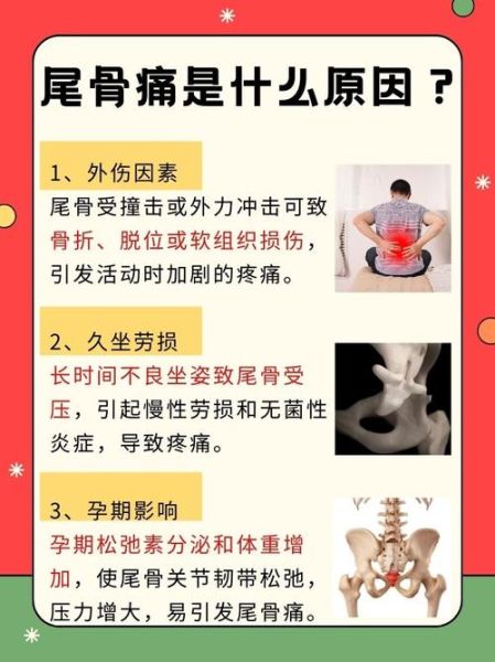 孕妇尾巴骨疼什么原因_如何缓解-第1张图片-星辰妙记