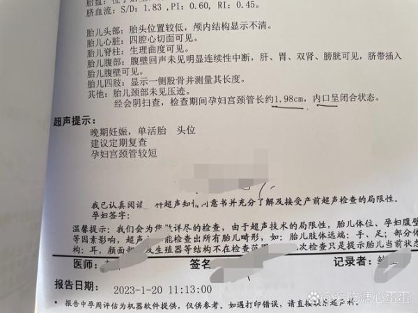宫颈短孕妇如何保胎_宫颈短保胎方法有哪些-第2张图片-星辰妙记 宫颈短孕妇如何保胎_宫颈短保胎方法有哪些-第2张图片-星辰妙记