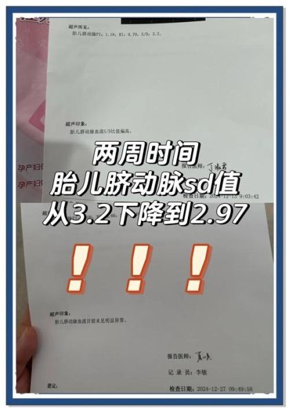 孕妇sd值正常范围_孕妇sd值偏高怎么办-第1张图片-星辰妙记