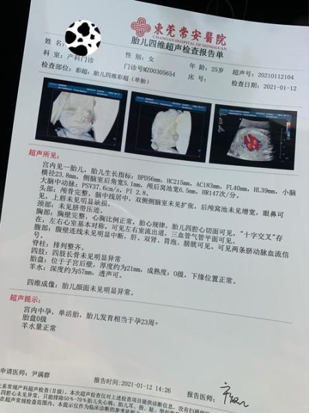 孕妇5个月四维彩超怎么看_四维彩超检查什么-第2张图片-星辰妙记